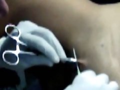Piercing of clit