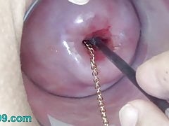 Extreme Cervix Playing - top rated XXX tube